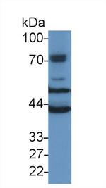 TUBB6 Antibody in Western Blot (WB)