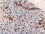 TUBD1 Polyclonal Antibody