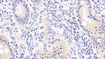 TUBD1 Polyclonal Antibody