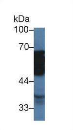 TUBD1 Antibody in Western Blot (WB)