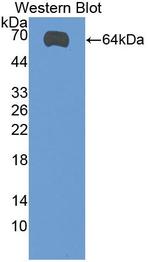 TUBD1 Antibody in Western Blot (WB)