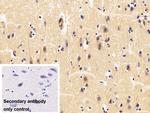 TNFR1 Antibody in Immunohistochemistry (Paraffin) (IHC (P))