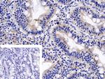 TNFR1 Antibody in Immunohistochemistry (Paraffin) (IHC (P))