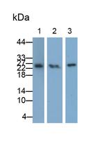 TNFR1 Antibody in Western Blot (WB)