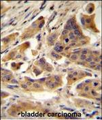 RBCK1 Polyclonal Antibody