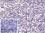 p53 Antibody in Immunohistochemistry (Paraffin) (IHC (P))