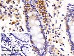 p53 Antibody in Immunohistochemistry (Paraffin) (IHC (P))