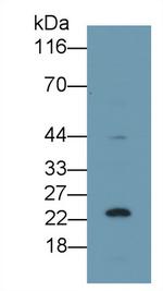 p53 Antibody in Western Blot (WB)