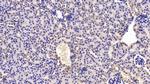 TSG Antibody in Immunohistochemistry (Paraffin) (IHC (P))