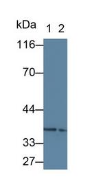 TSG Antibody in Western Blot (WB)