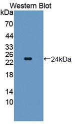 TSG Antibody in Western Blot (WB)