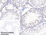 PGP9.5 Antibody in Immunohistochemistry (Paraffin) (IHC (P))