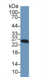PGP9.5 Antibody in Western Blot (WB)