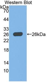 PGP9.5 Antibody in Western Blot (WB)