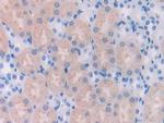UCHL4 Polyclonal Antibody