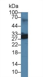 UCHL4 Antibody in Western Blot (WB)