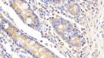 UBE2S Polyclonal Antibody