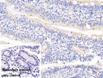 UCN2 Polyclonal Antibody