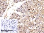 VCP Polyclonal Antibody