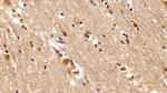 VCP Antibody in Immunohistochemistry (Paraffin) (IHC (P))