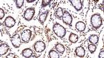 VCP Antibody in Immunohistochemistry (Paraffin) (IHC (P))