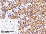 VCP Antibody in Immunohistochemistry (Paraffin) (IHC (P))
