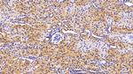 VCP Antibody in Immunohistochemistry (Paraffin) (IHC (P))