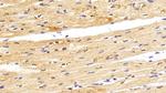 VCP Antibody in Immunohistochemistry (Paraffin) (IHC (P))