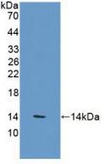 VNN1 Antibody in Western Blot (WB)
