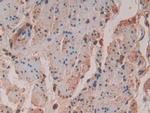 VAV3 Polyclonal Antibody