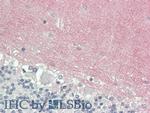 VCAN Antibody in Immunohistochemistry (Paraffin) (IHC (P))