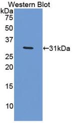 VCAN Antibody in Western Blot (WB)