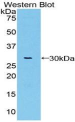 VWA1 Antibody in Western Blot (WB)