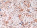 VWA3A Antibody in Immunohistochemistry (Paraffin) (IHC (P))