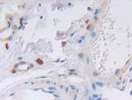 VWA3A Polyclonal Antibody