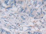 VWA3A Antibody in Immunohistochemistry (Paraffin) (IHC (P))
