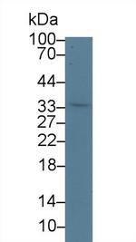 WFDC1 Antibody in Western Blot (WB)