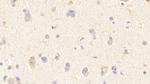 WASP Polyclonal Antibody
