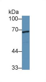 WASP Antibody in Western Blot (WB)