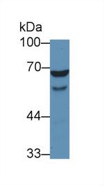 WASP Antibody in Western Blot (WB)