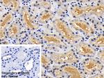 XIAP Antibody in Immunohistochemistry (Paraffin) (IHC (P))