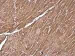 Cardiac Troponin T Polyclonal Antibody