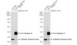 Cathepsin B Antibody in Western Blot (WB)