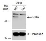 CDK2 Polyclonal Antibody