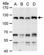 CHD1L Antibody in Western Blot (WB)