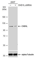 CHD1L Polyclonal Antibody