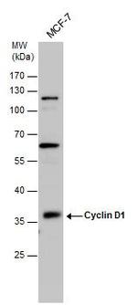 Cyclin D1 Antibody in Western Blot (WB)