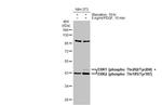 Phospho-ERK1/ERK2 (Thr185, Tyr187, Thr202, Tyr204) Antibody in Western Blot (WB)