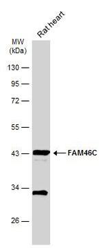 FAM46C Antibody in Western Blot (WB)