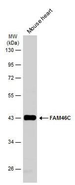 FAM46C Antibody in Western Blot (WB)